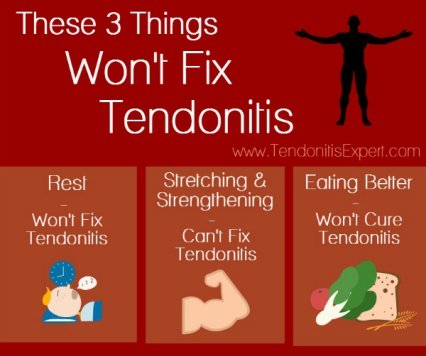 Tendonitis Treatment Options That Work And Dont Work 0255